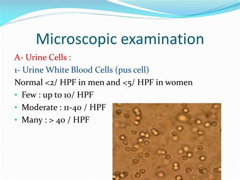 pus cells in urine normal range hpf|Epithelial Cells in Urine: Types, Test Results, Causes, .